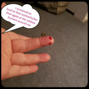 bleeding finger from mouse bite